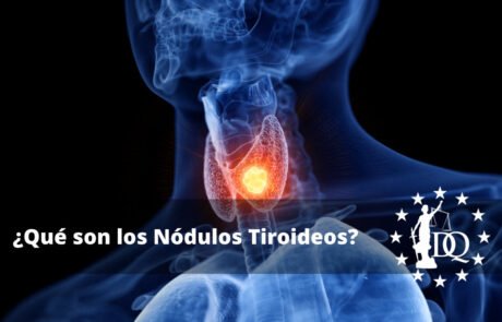 Qué son los Nódulos Tiroideos