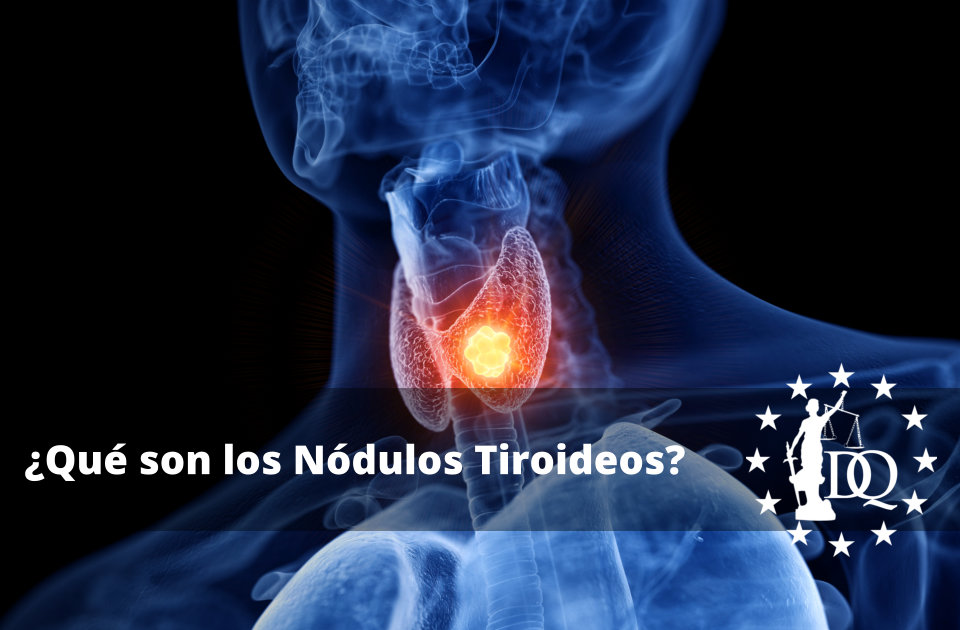 Qué son los Nódulos Tiroideos